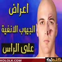 الدوخة والصداع من أعراض الجيوب الأنفية وكيف علاجها