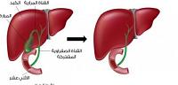أين توجد وتقع المرارة في جسم الإنسان